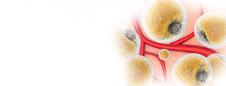 Lipid panel